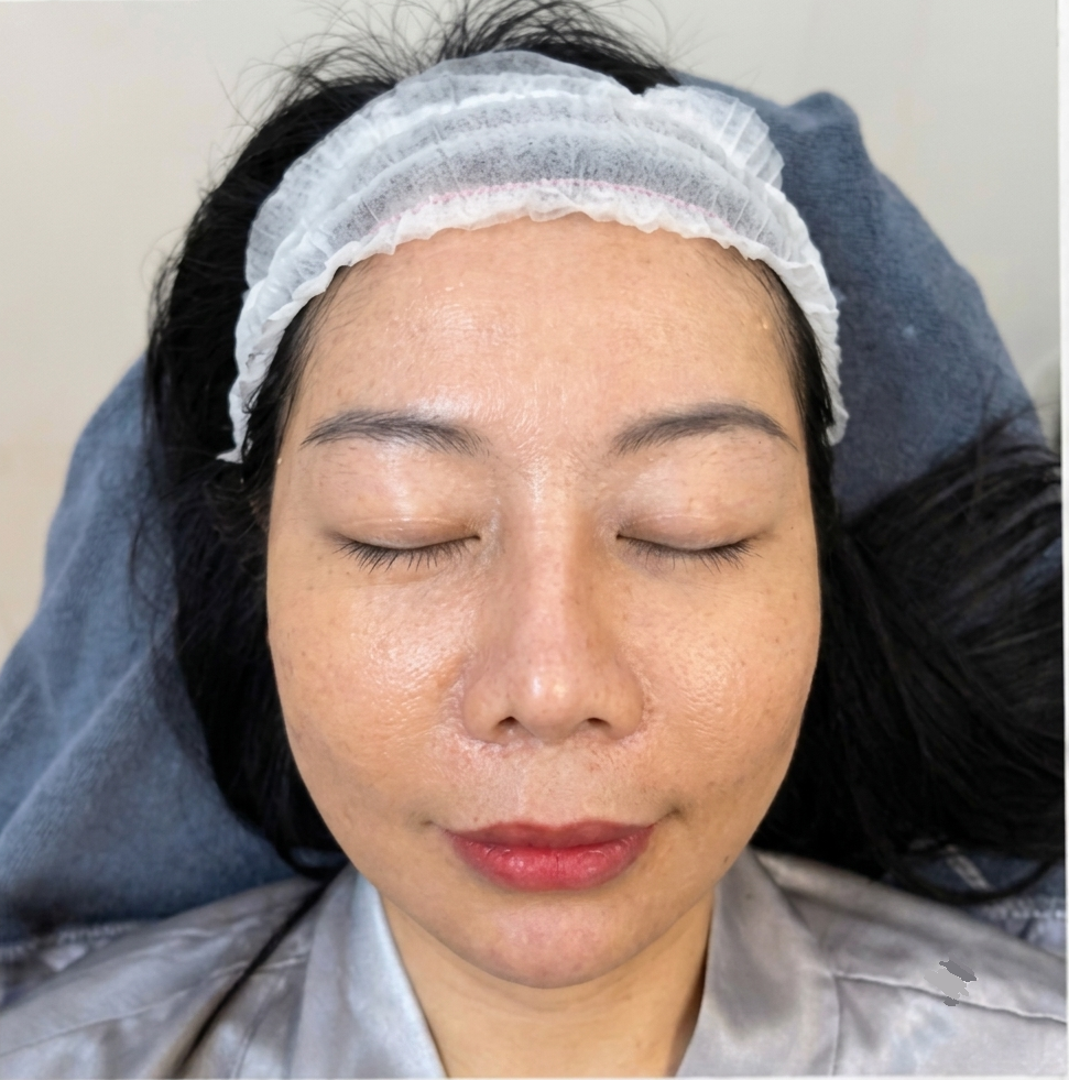 Sau liệu trình