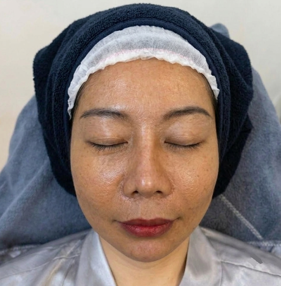 Trước liệu trình