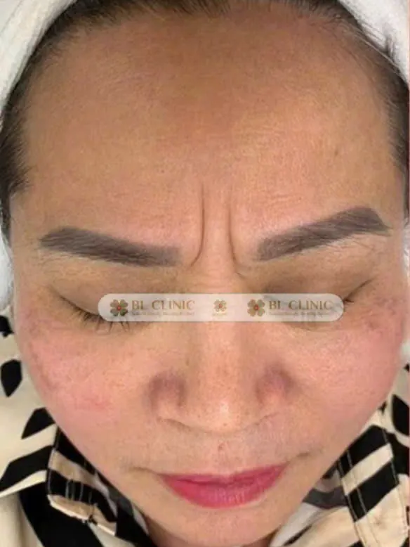 Trước
