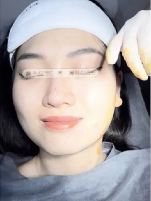 Trước