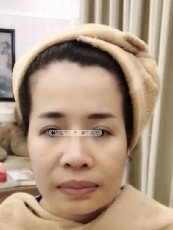 Trước