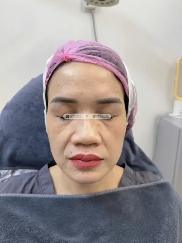 Trước