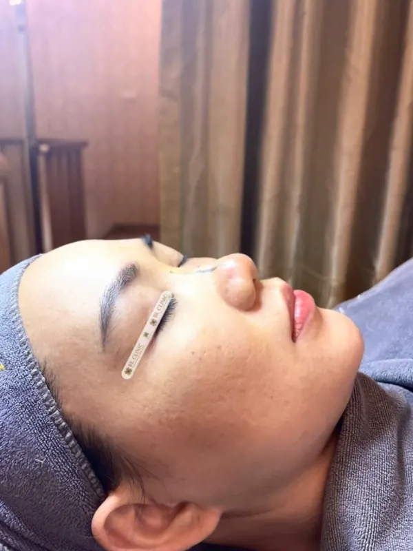 Trước