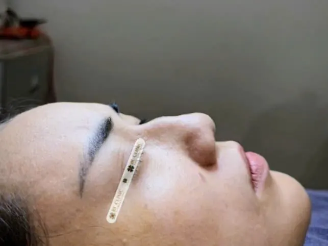 Trước