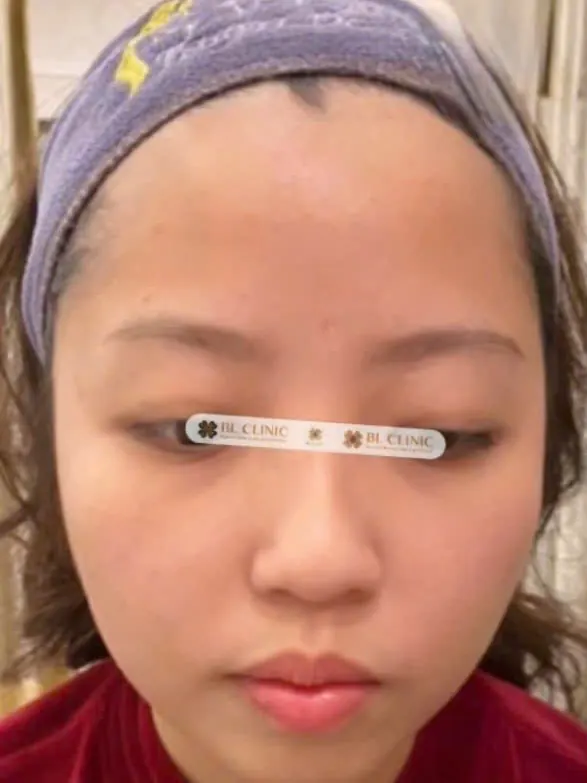 Trước
