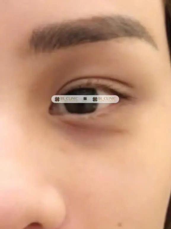 Trước