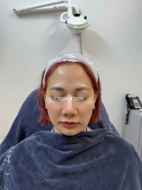 Trước