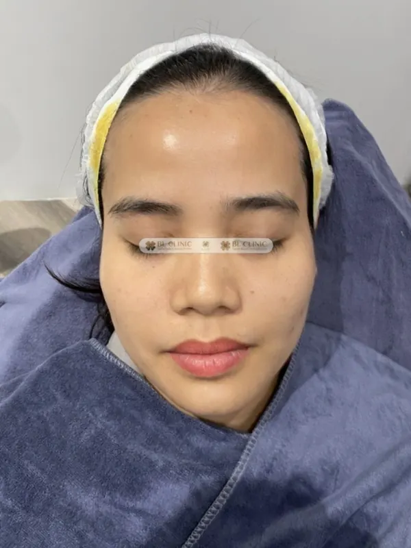 Trước