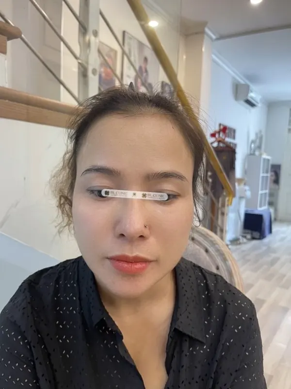 Trước