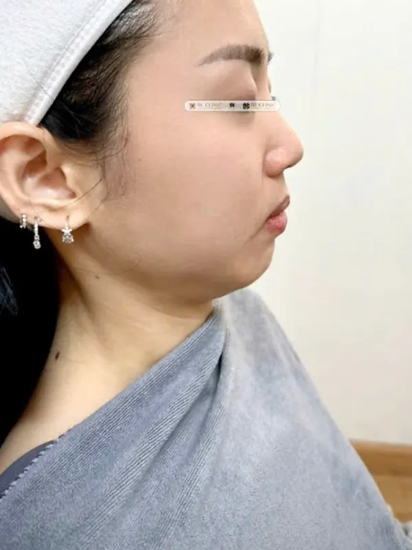 Trước