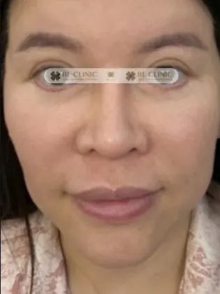 Trước