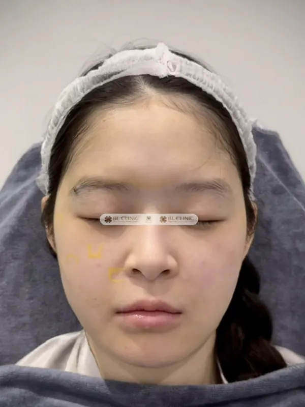 Trước