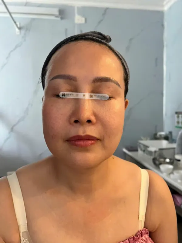 Trước