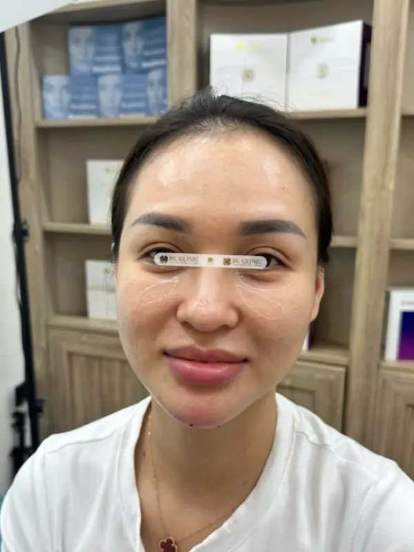 Trước