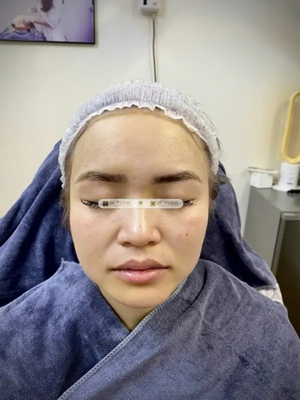 Trước