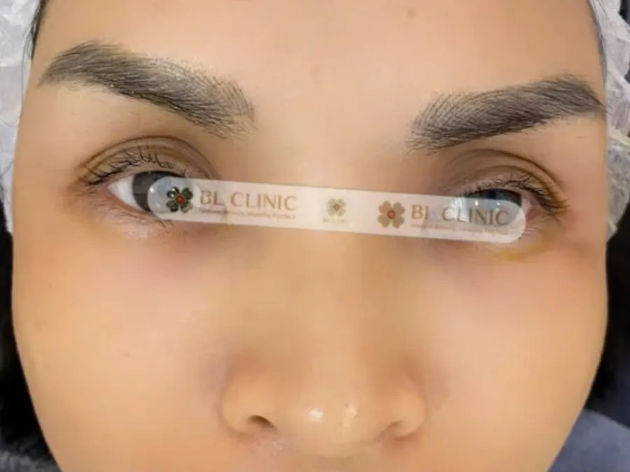Trước
