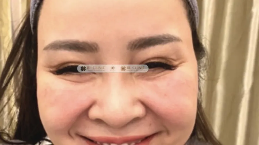 Trước