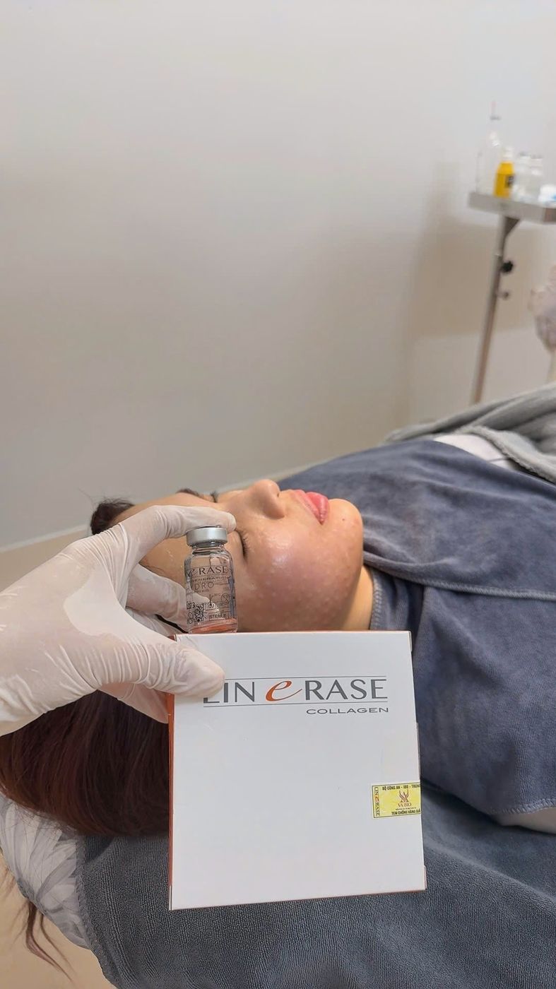 Linerase tại BL Clinic
